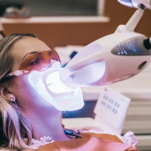 Izbjeljivanje zuba stomatoloska ordinacija oralis cazin