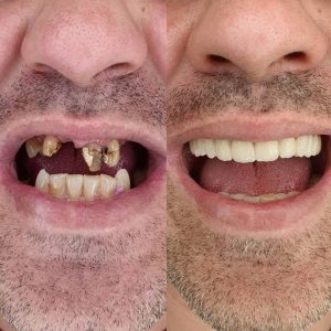 Stomatoloska ordinacija Oralis Cazin