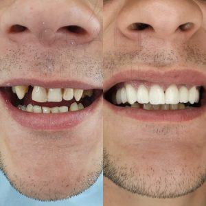 Stomatoloska ordinacija Oralis Cazin