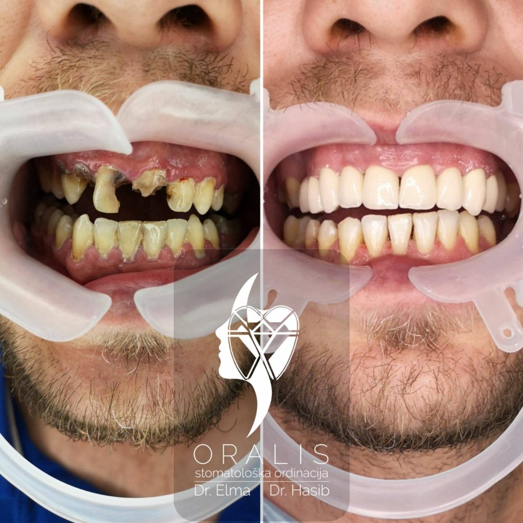 Stomatoloska ordinacija Oralis Cazin